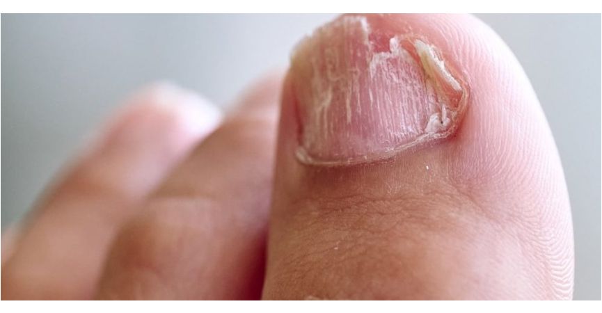 MYKOGEN GOLD bioenzymatyczne masełko złuszczające do paznokci NOWOŚĆ